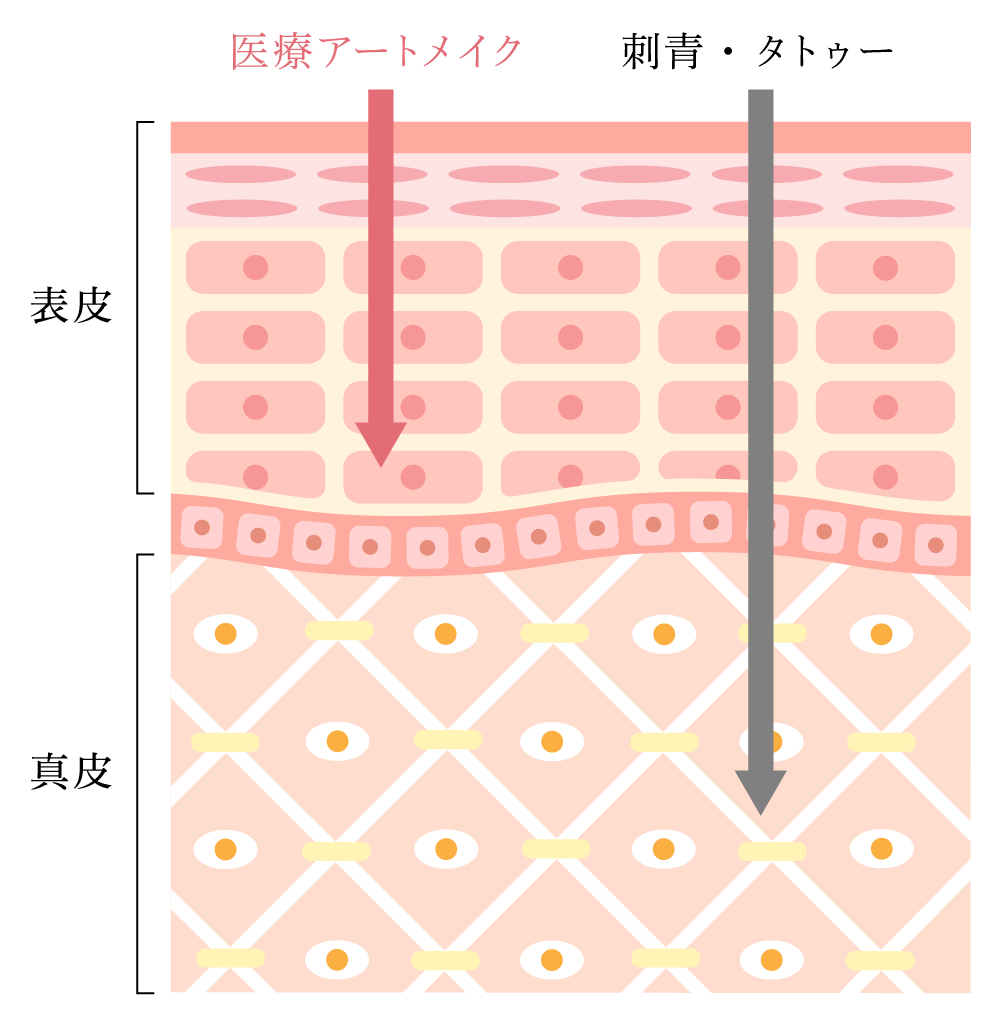 皮膚の断面図。アートメイクは表皮に、タトゥーは真皮に色素を入れる